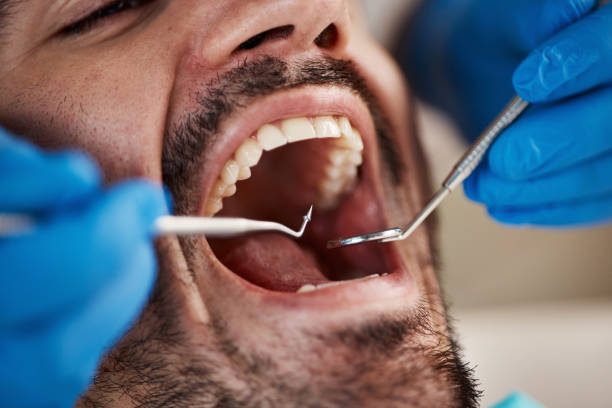 Best Emergency Treatment for Dental Infections or Abscesses in Archbold, OH